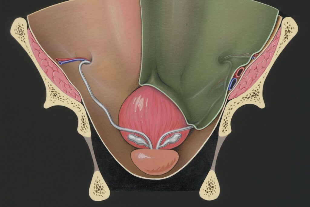 Title: Prostate and adjacent tissue Creator: Tinkelenberg, J Date: 1970-04-02 Providing institution: Universitaire Bibliotheken Leiden Aggregator: Dutch Collections for Europe Providing Country: Netherlands Public Domain Prostate and adjacent tissue by Tinkelenberg, J - Leiden University Libraries, Netherlands - Public Domain. https://www.europeana.eu/item/744/item_3462041