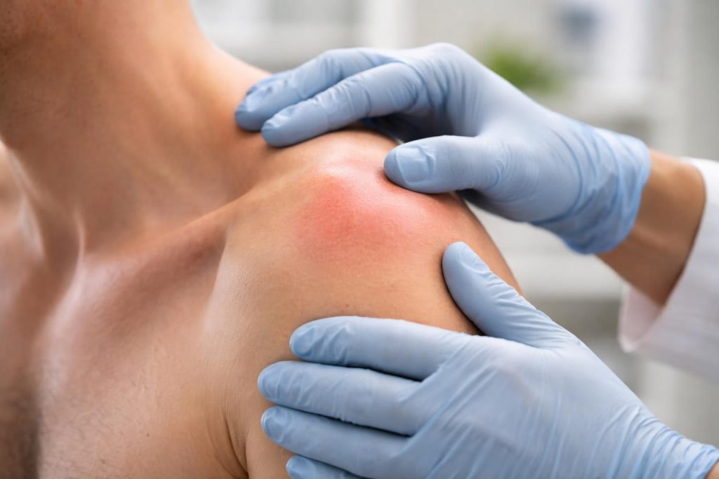 découvrez pourquoi la capsulite de l'épaule reste difficile à soigner malgré les traitements et pourquoi aucun remède miracle n'existe pour cette inflammation.